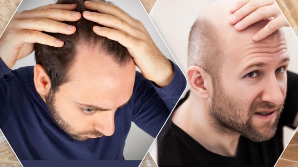 Volles Haar haben